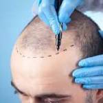 Asg Hair transplant Centre Profile Picture