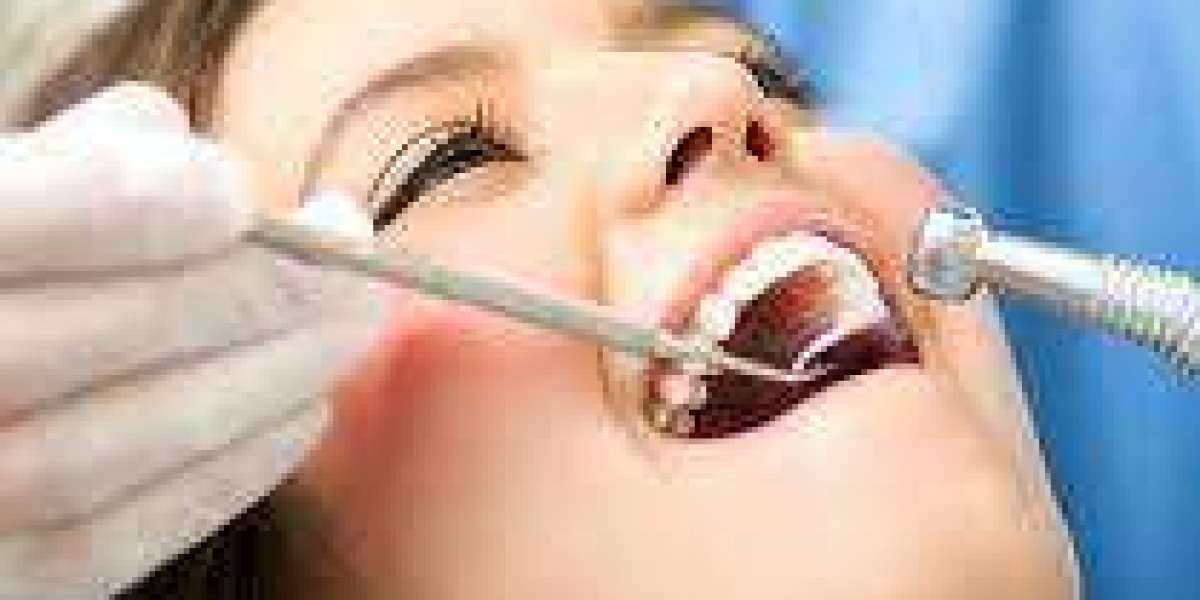 Ranch Tooth: The Ultimate Guide to Maintaining Optimal Dental Health