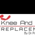 Knee Joint Replacement Profile Picture
