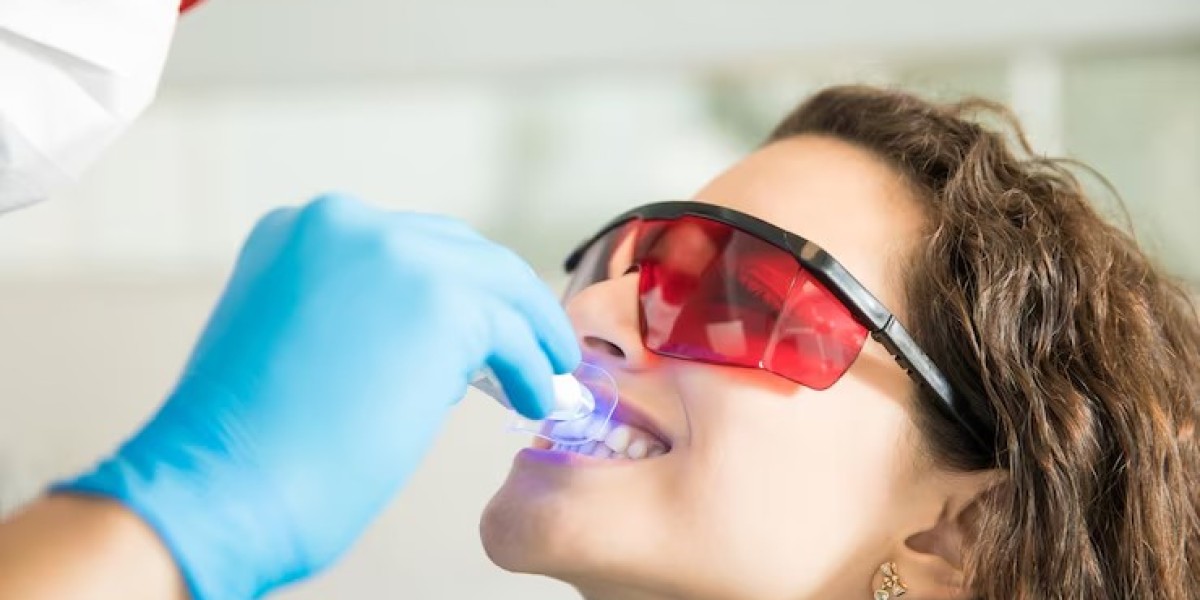 The Science Behind Teeth Whitening: Comparing Methods for a Dazzling Smile