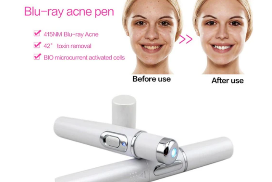 Step-by-Step: Using a Blue Light Acne Laser Pen for Clearer Skin