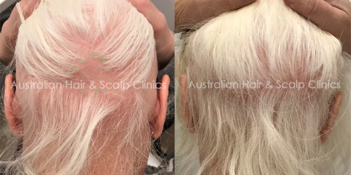 Get Healthier Locks Natural Hair Treatment Specialist in Melbourne