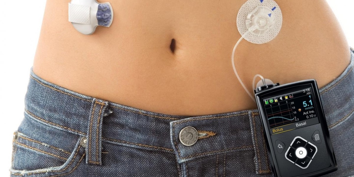  Global Insulin Pumps Industry, with estimated revenues of US$ 5.5 billion in 2022