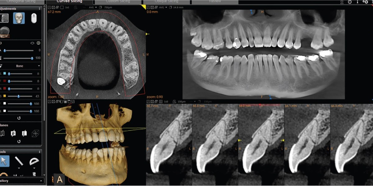 Beyond the X-Ray: 3D Imaging Revolutionizes Dentistry with CBCT Scans