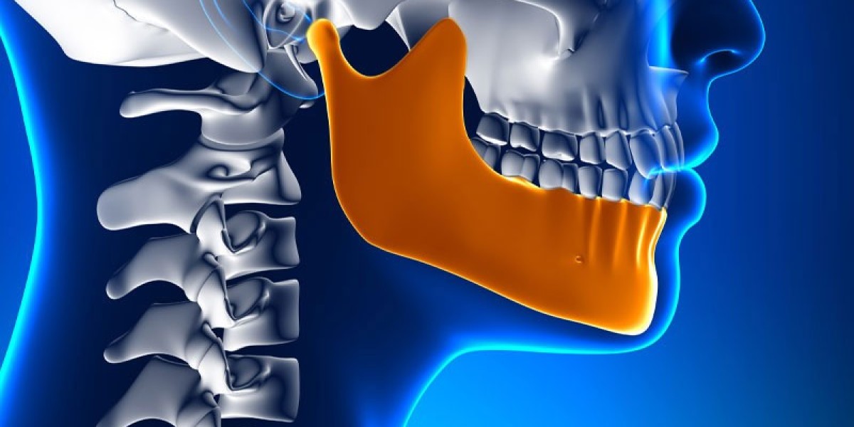 From Facial Symmetry to Function: The Regional Appeal of TMJ Implants (2024 Analysis)