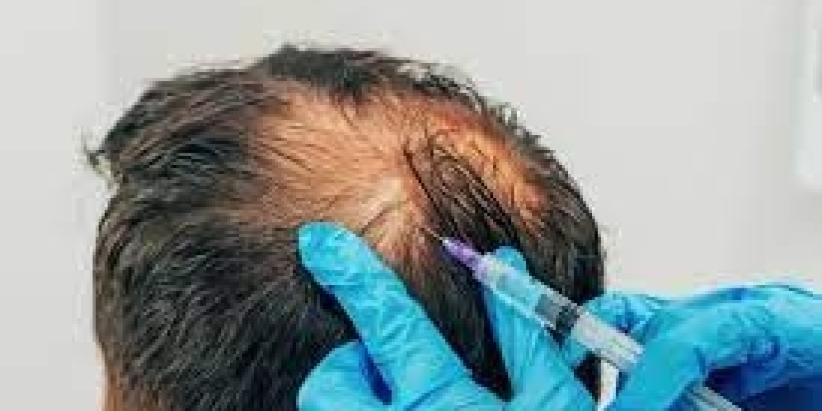 The Future of Hair Filler Treatments in Dubai: What to Expect