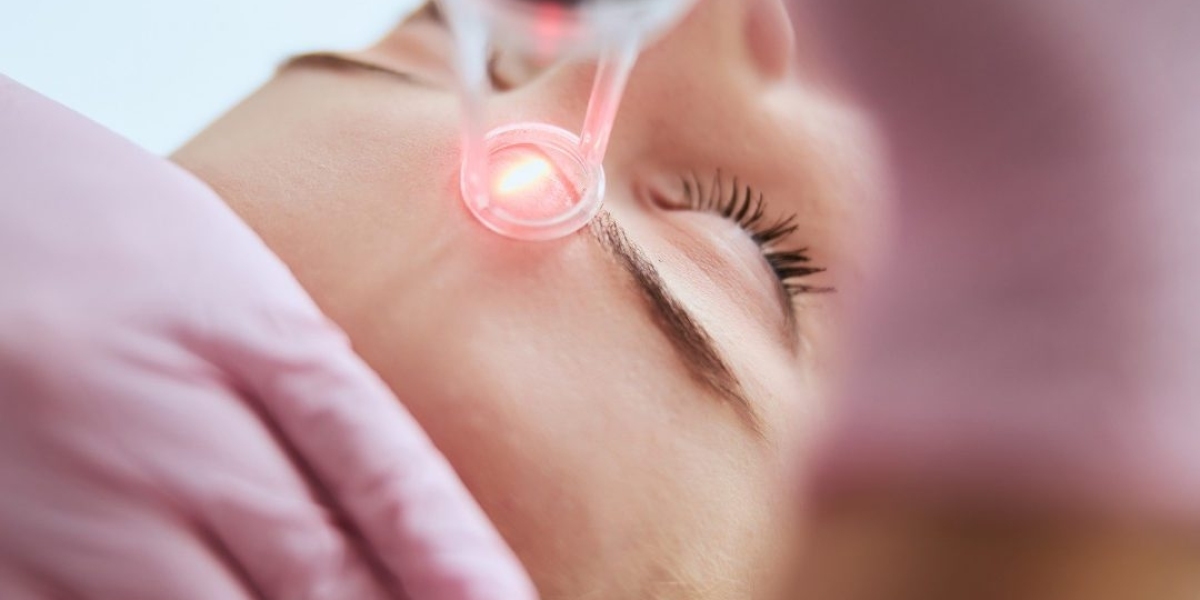 How To Prepare For Laser Skin Resurfacing Procedure?