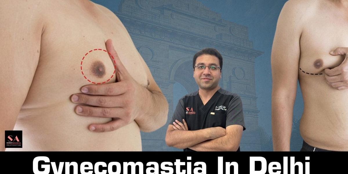 Best Gynecomastia Surgery in Delhi: A Detailed Guide to Treatment and Recovery
