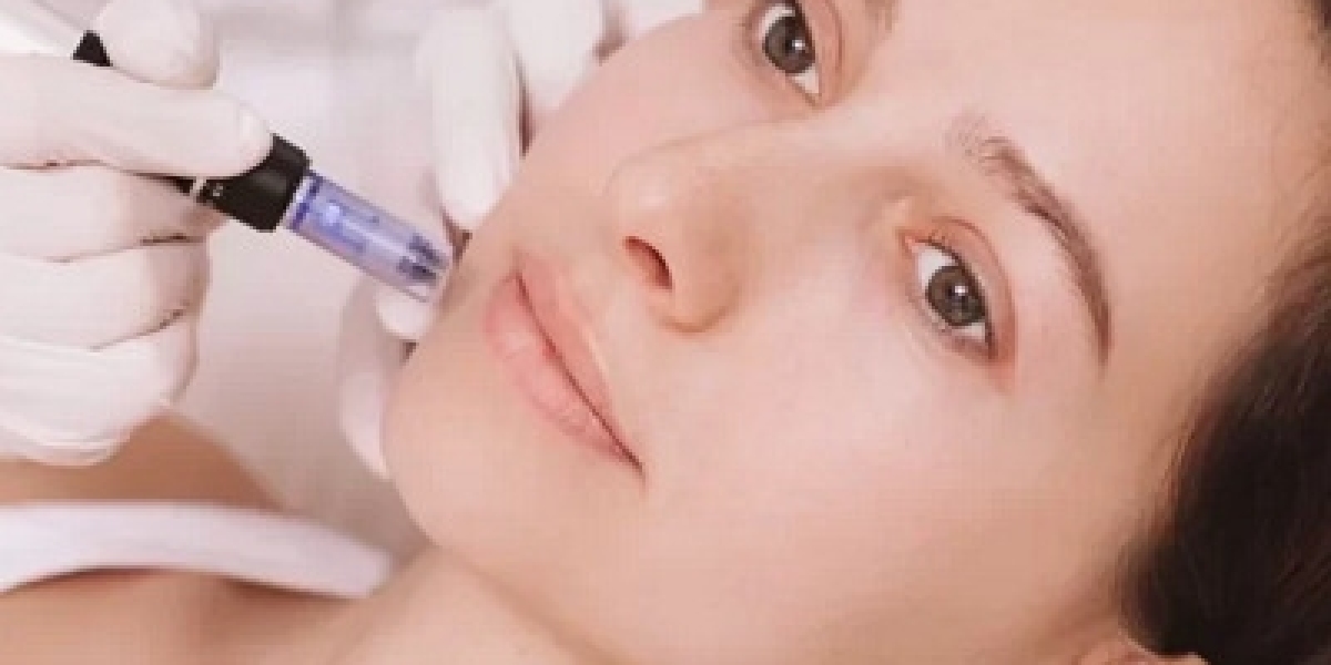 Microneedling with PRP Treatment Cost in Dubai