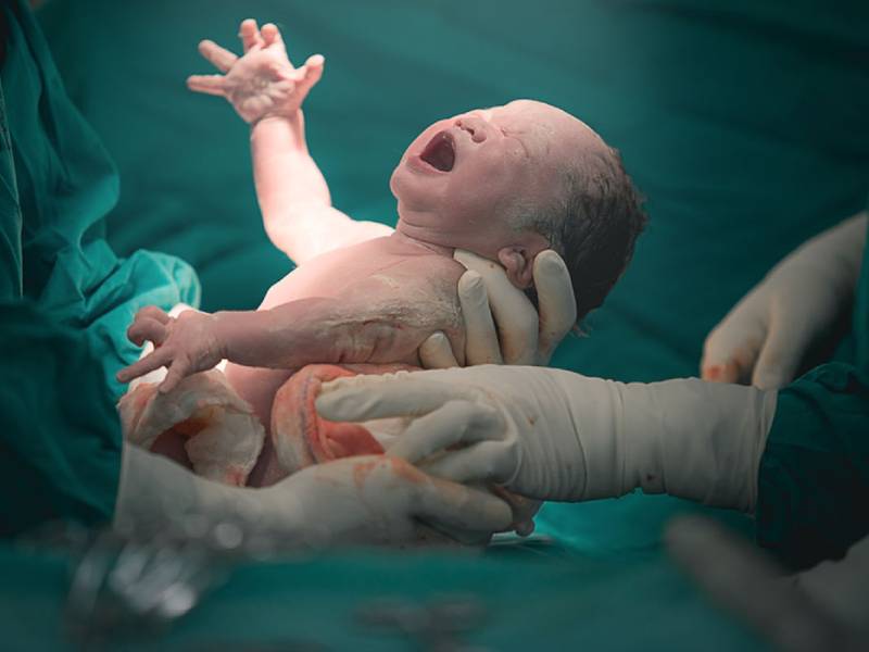 Normal Delivery Consultation in Pune Wakad - Dr. Asmita Dongare