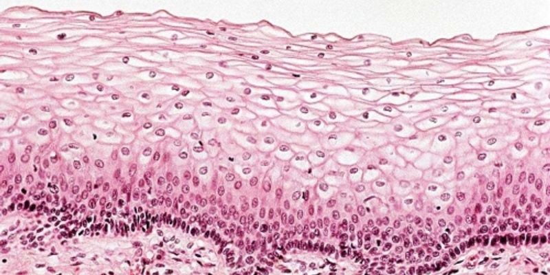 Epithelial and Endothelial Cells- How Do They Differ? - Kosheeka